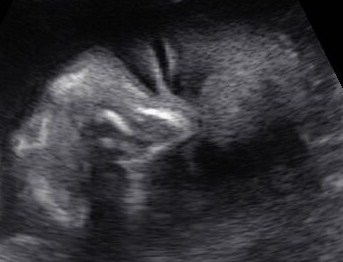 2D Baby Face Sonar Scan