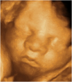 3D Baby Face Sonar Scan