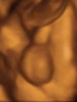 3d_4d_ultrasound_scan_image_boy