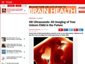 time ge hd ultrasound thumbnail